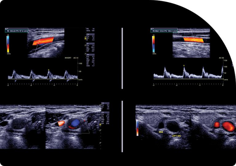 General Ultrasound | Saddletown Radiology | NE Calgary